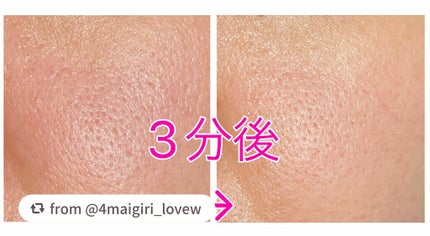 スキンライトセラピーII/Makeon/美顔器・マッサージを使ったクチコミ(2枚目)