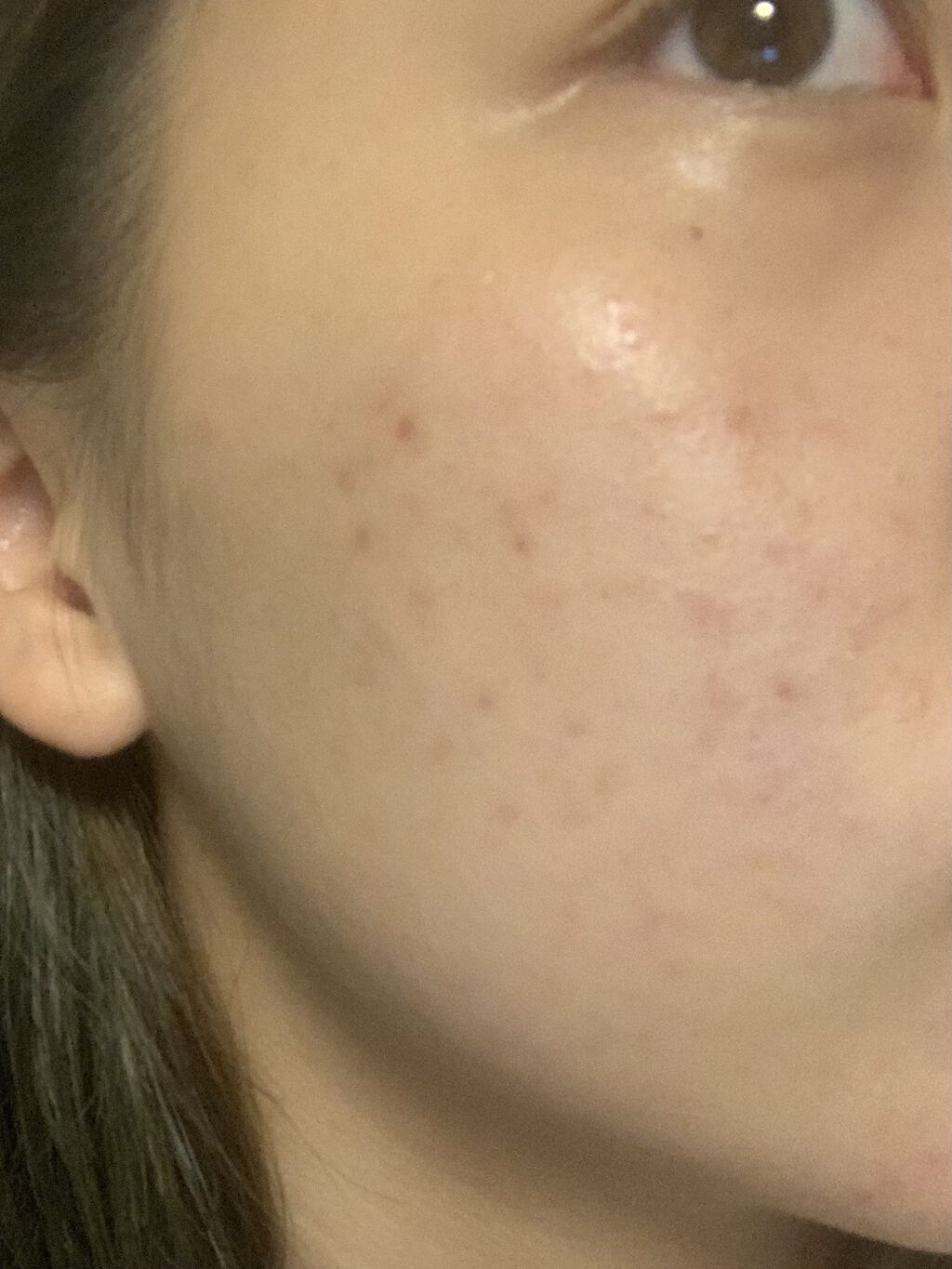 白潤 薬用美白化粧水(しっとりタイプ)/肌ラボ/化粧水を使ったクチコミ（1枚目）