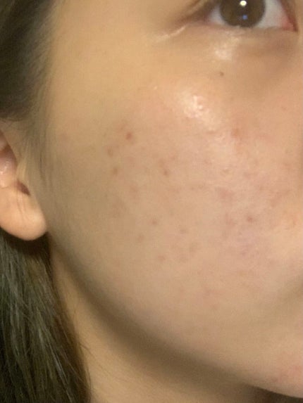 白潤 薬用美白乳液/肌ラボ/乳液を使ったクチコミ(1枚目)