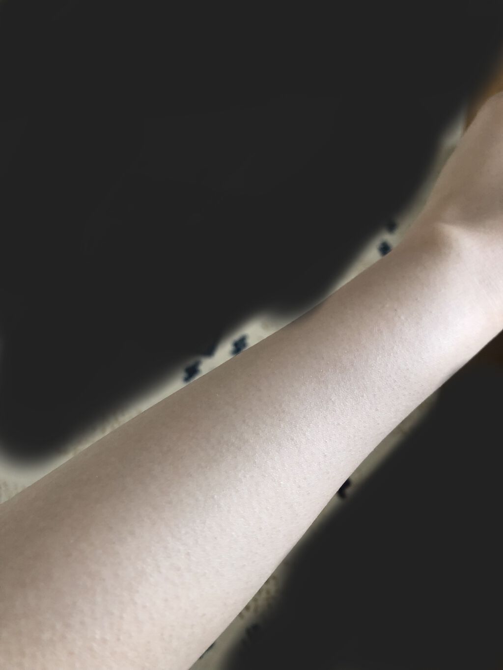 レイボーテ ヴィーナス/YA-MAN TOKYO JAPAN/家庭用脱毛器を使ったクチコミ（2枚目）