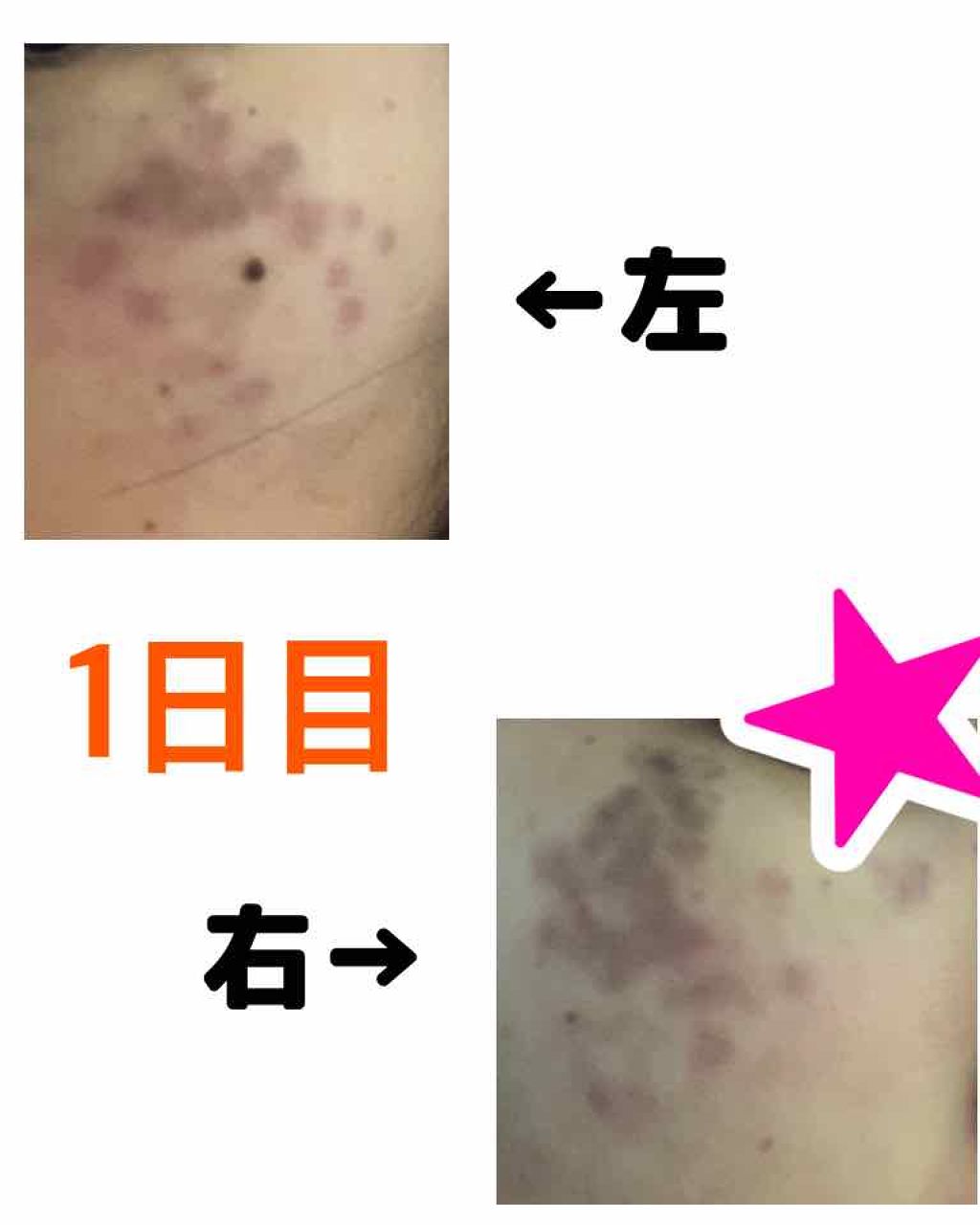 を使ったクチコミ（2枚目）