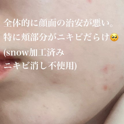 デュオ ザ クレンジングバーム ブラック/DUO/クレンジングバームを使ったクチコミ(5枚目)