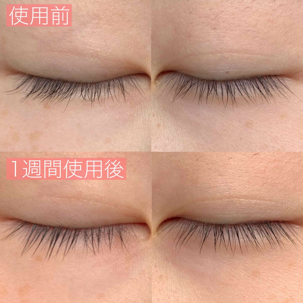 ラブ・ライナー オールラッシュ セラム<まつげ美容液>/ラブ・ライナー/まつげ美容液を使ったクチコミ(2枚目)