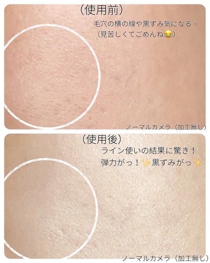 グリーントマトクレイマスククレンザー/FULLY/洗い流すパック・マスクを使ったクチコミ(8枚目)