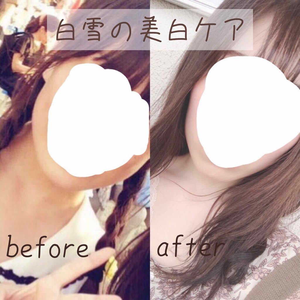 白潤プレミアム 薬用浸透美白化粧水/肌ラボ/化粧水を使ったクチコミ(1枚目)