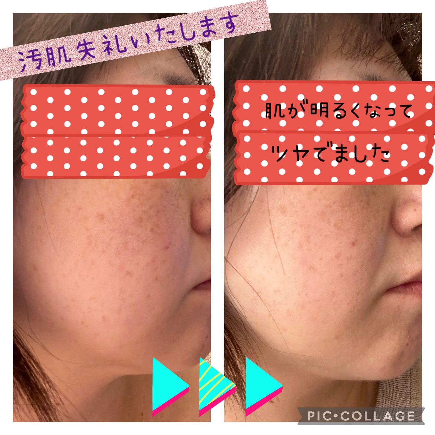 UVイデア XL プロテクショントーンアップ クリア/ラ ロッシュ ポゼ/化粧下地を使ったクチコミ(3枚目)