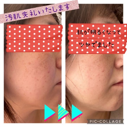 UVイデア XL プロテクショントーンアップ クリア/ラ ロッシュ ポゼ/化粧下地を使ったクチコミ(3枚目)