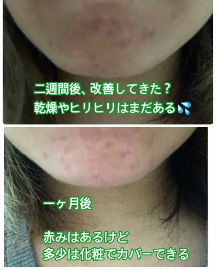 DHC マルチビタミン/DHC/美容サプリメントを使ったクチコミ(4枚目)