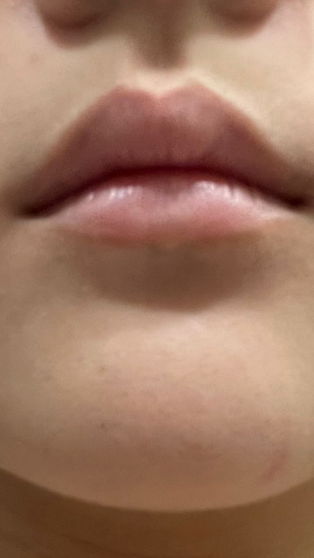 ドトムリッププラスプランパー/keybo/リッププランパーを使ったクチコミ（3枚目）