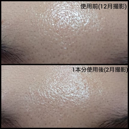 ジェニフィック アドバンスト N/LANCOME/美容液を使ったクチコミ(2枚目)