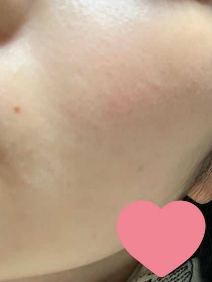 化粧水 しっとりタイプ/ちふれ/化粧水を使ったクチコミ(2枚目)