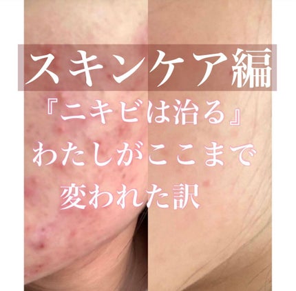 ザ・タイムR アクア/IPSA/化粧水を使ったクチコミ(1枚目)