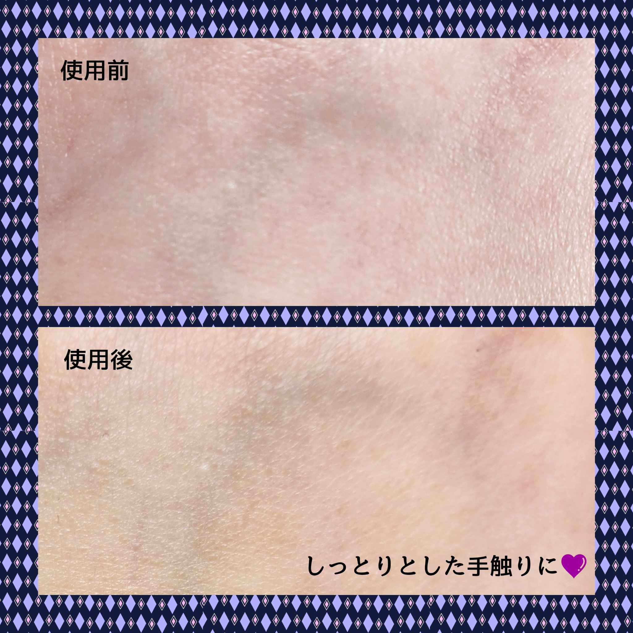 ペプチド ボリューム マスター エッセンス/DR.PEPTI/美容液を使ったクチコミ（3枚目）