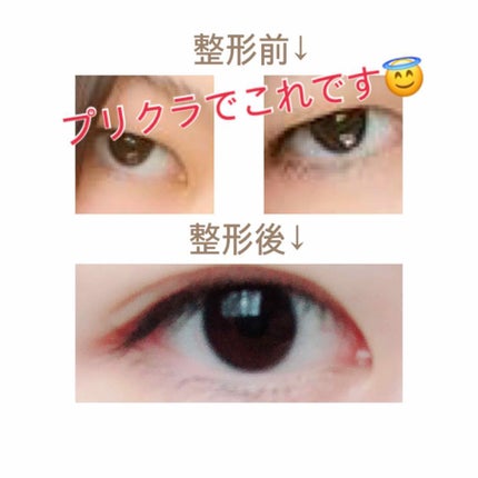 二重の作り方/その他を使ったクチコミ(2枚目)