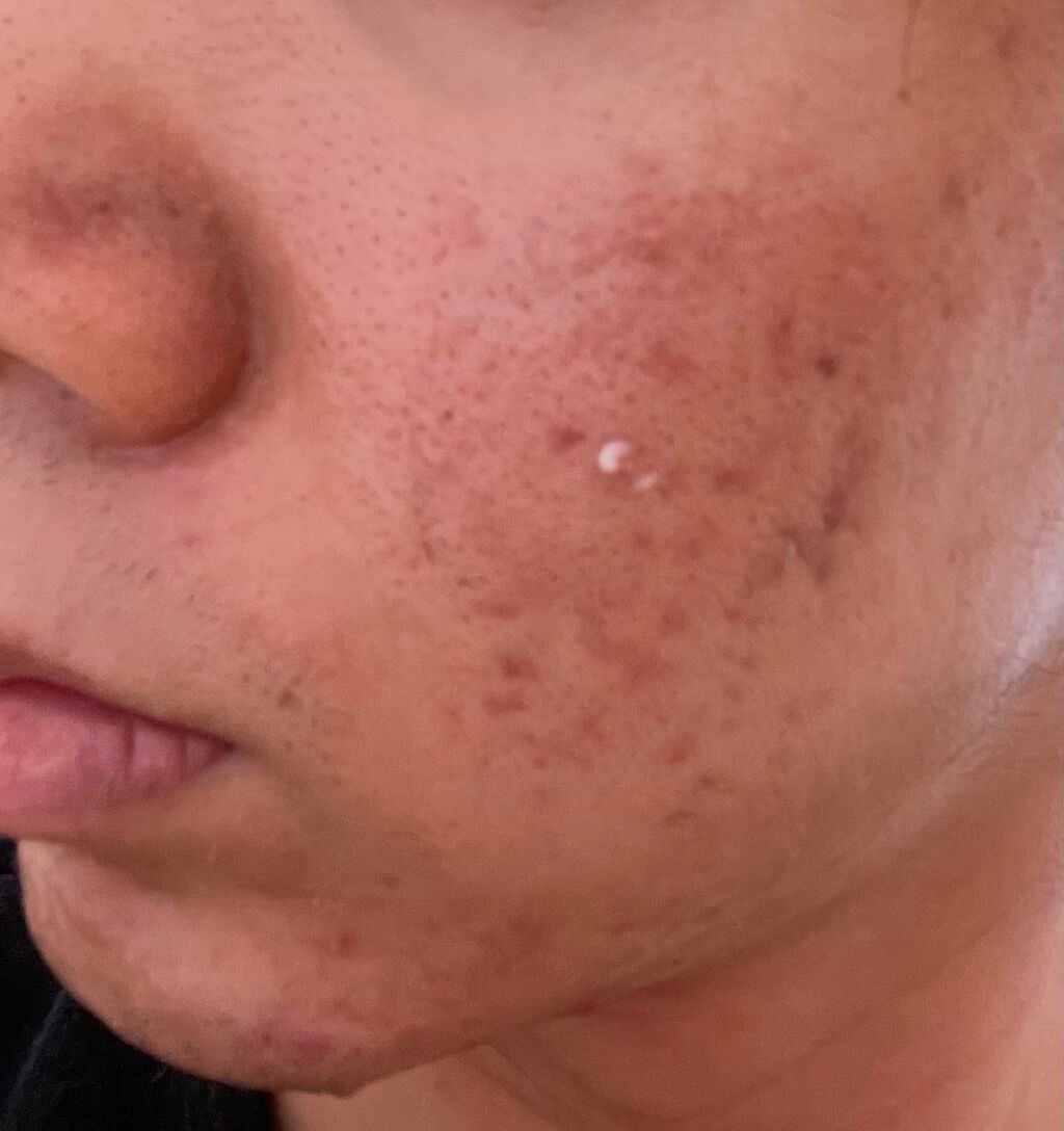 かとう on LIPS 「メモ7/23治ってきてると信じたい!(朝なのでナジフロあり)自..」(3枚目)