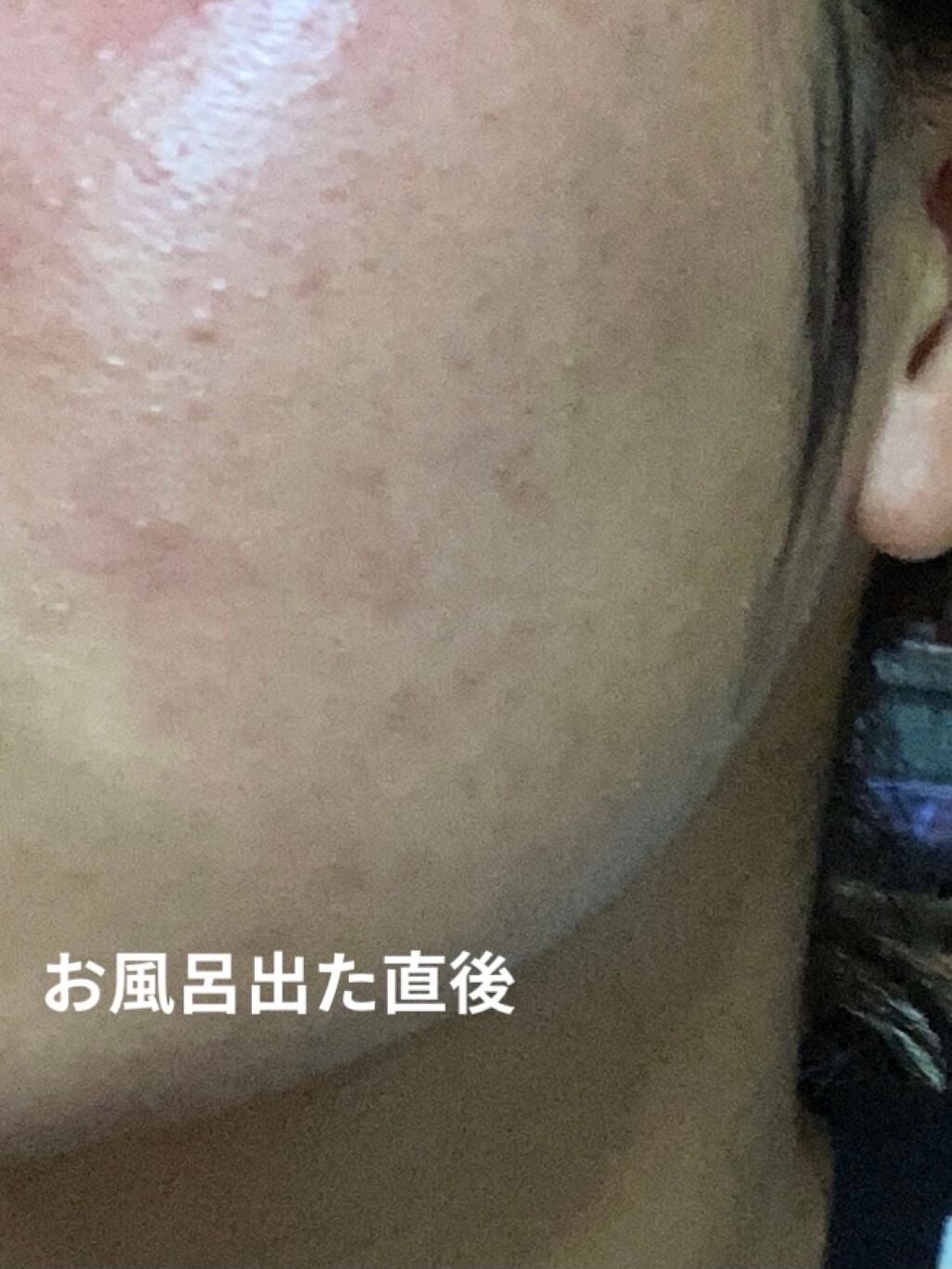 学生 on LIPS 「〜ワフーメイド酒粕パック〜¥1200+税〜私の肌〜・敏感肌・脂..」(3枚目)