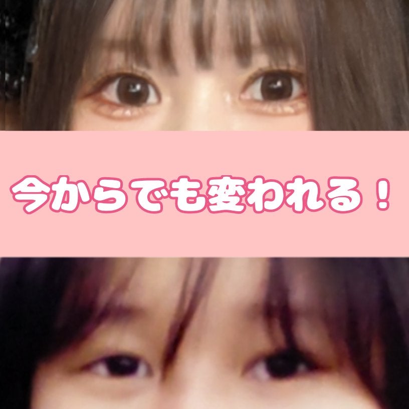 らぃちる on LIPS 「目のサイズも目つきも変わった私的垢抜け方法※目のサイズ加工整形..」(5枚目)