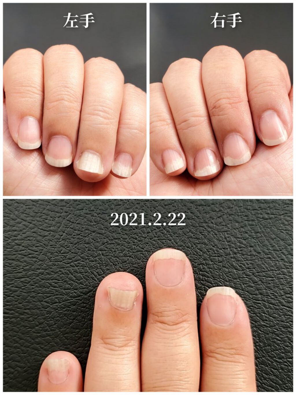 エテュセ クイックケアコート/ettusais/ネイルオイル・トリートメントを使ったクチコミ（3枚目）