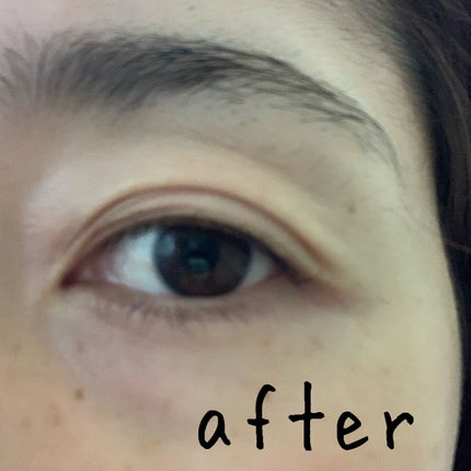 リッドキララ/北の快適工房/アイケア・アイクリームを使ったクチコミ(3枚目)