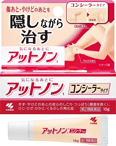 試してみた アットノン コンシーラータイプ 16年4月6日発売 医薬品 アットノン Lips