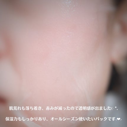 シカフルカーミングマスク/beplain/シートマスク・パックを使ったクチコミ(6枚目)