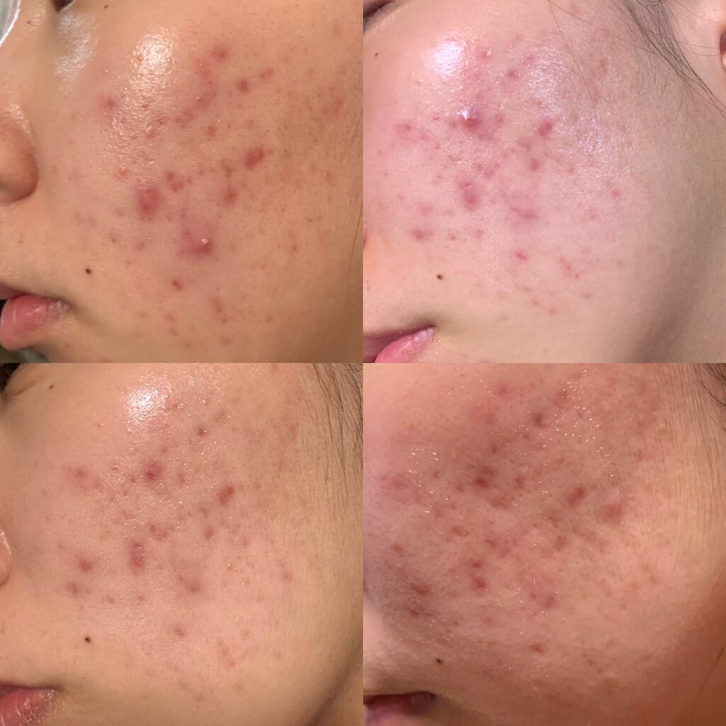 化粧落し/はしかた化粧品/クレンジングジェルを使ったクチコミ（2枚目）