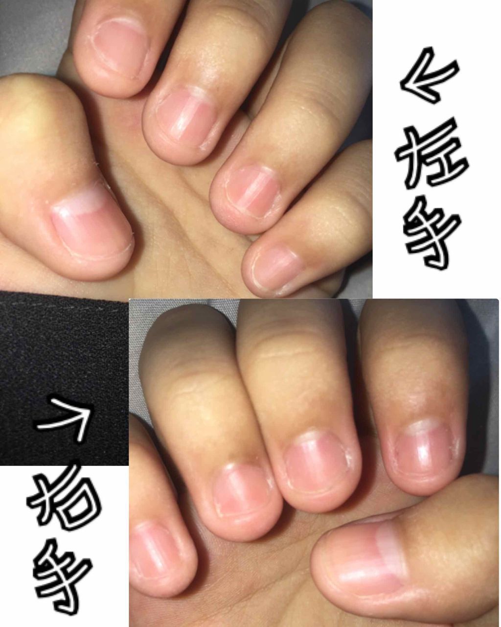 ❁深爪日記❁ on LIPS 「初めまして!今日から深爪日記を始めようと思います!💅🏼私、中々..」(2枚目)