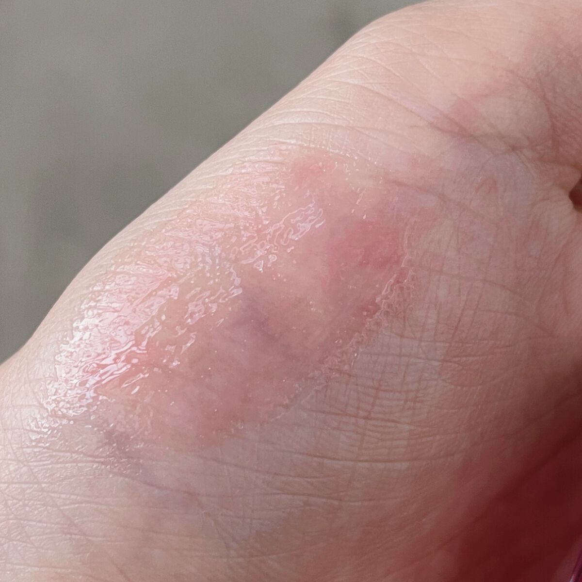 ジルスチュアート クリスタルブルーム リップブーケ セラム/JILL STUART/リッププランパーを使ったクチコミ(3枚目)