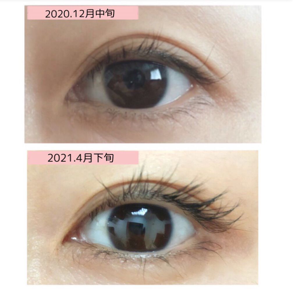 エグータム/アルマダスタイル/まつげ美容液を使ったクチコミ(5枚目)