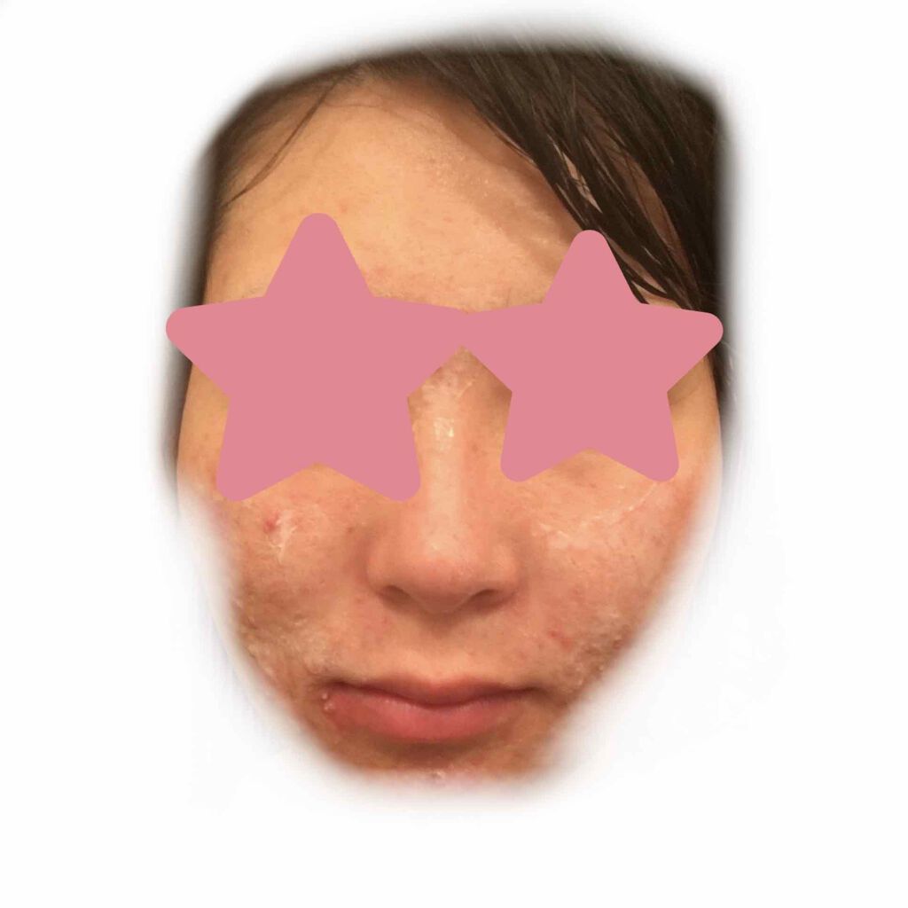 フェイスクレイウォッシュ/クレイビューティ/洗顔フォームを使ったクチコミ(2枚目)