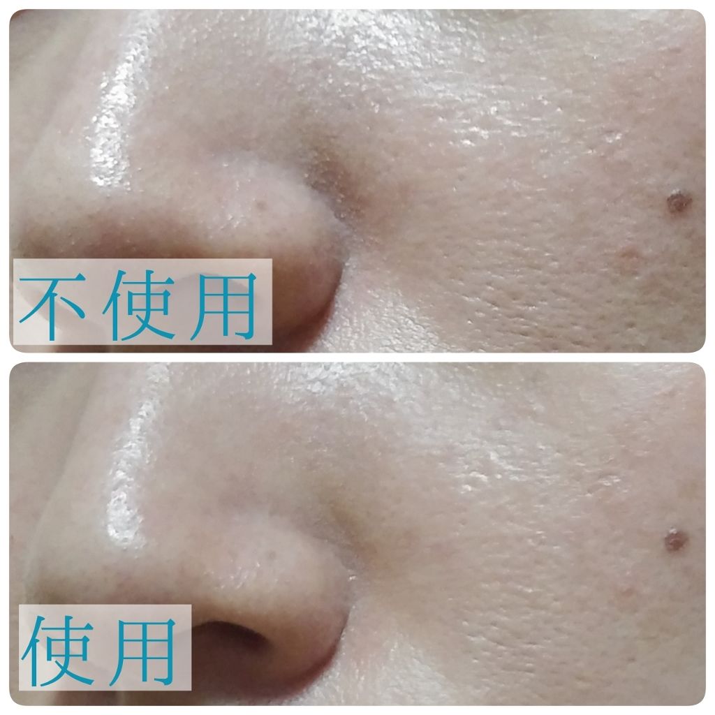 セロザンク/ラ ロッシュ ポゼ/ミスト状化粧水を使ったクチコミ(2枚目)