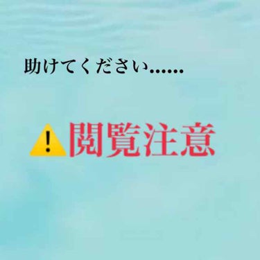 オードムーゲ 薬用ローション（ふきとり化粧水）/オードムーゲ/拭き取り化粧水を使ったクチコミ（1枚目）