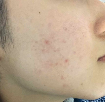 ビジャ シカバーム EX/innisfree/フェイスバームを使ったクチコミ(3枚目)