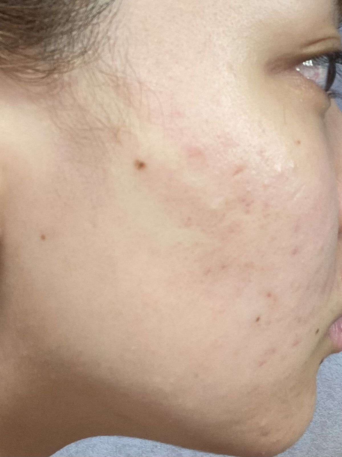 化粧水・敏感肌用・高保湿タイプ/無印良品/化粧水を使ったクチコミ（2枚目）