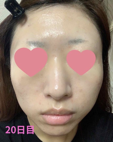 ボラージ クリーム/ちふれ/ボディクリームを使ったクチコミ(2枚目)