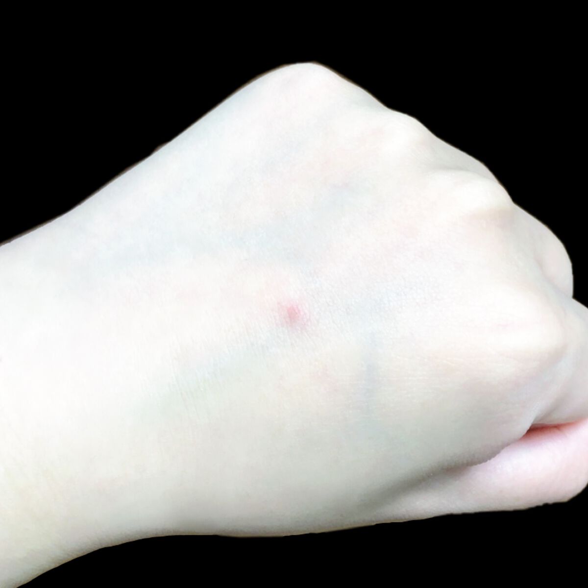 タトゥーウォータープルーフスカーコンシーラー/フォレンコス/リキッドコンシーラーを使ったクチコミ（3枚目）