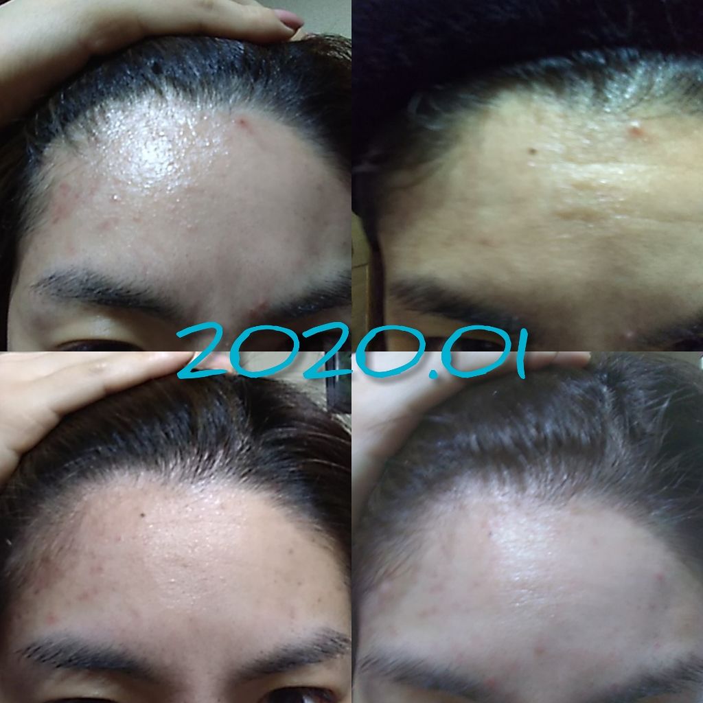 敏感肌用薬用美白美容液/無印良品/美容液を使ったクチコミ(2枚目)