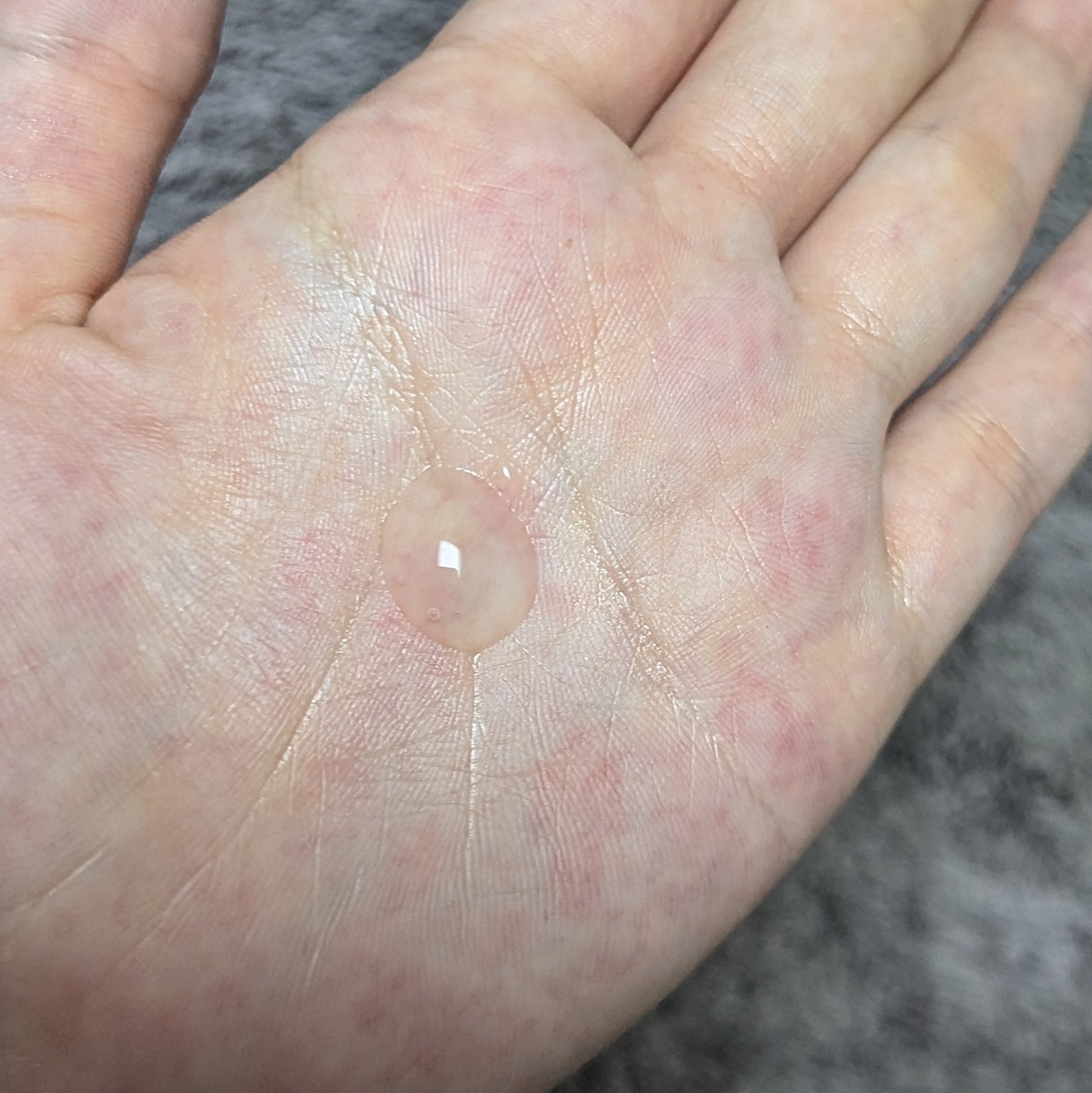 ナノグロウリッチ/iqumore/頭皮ローションを使ったクチコミ（3枚目）