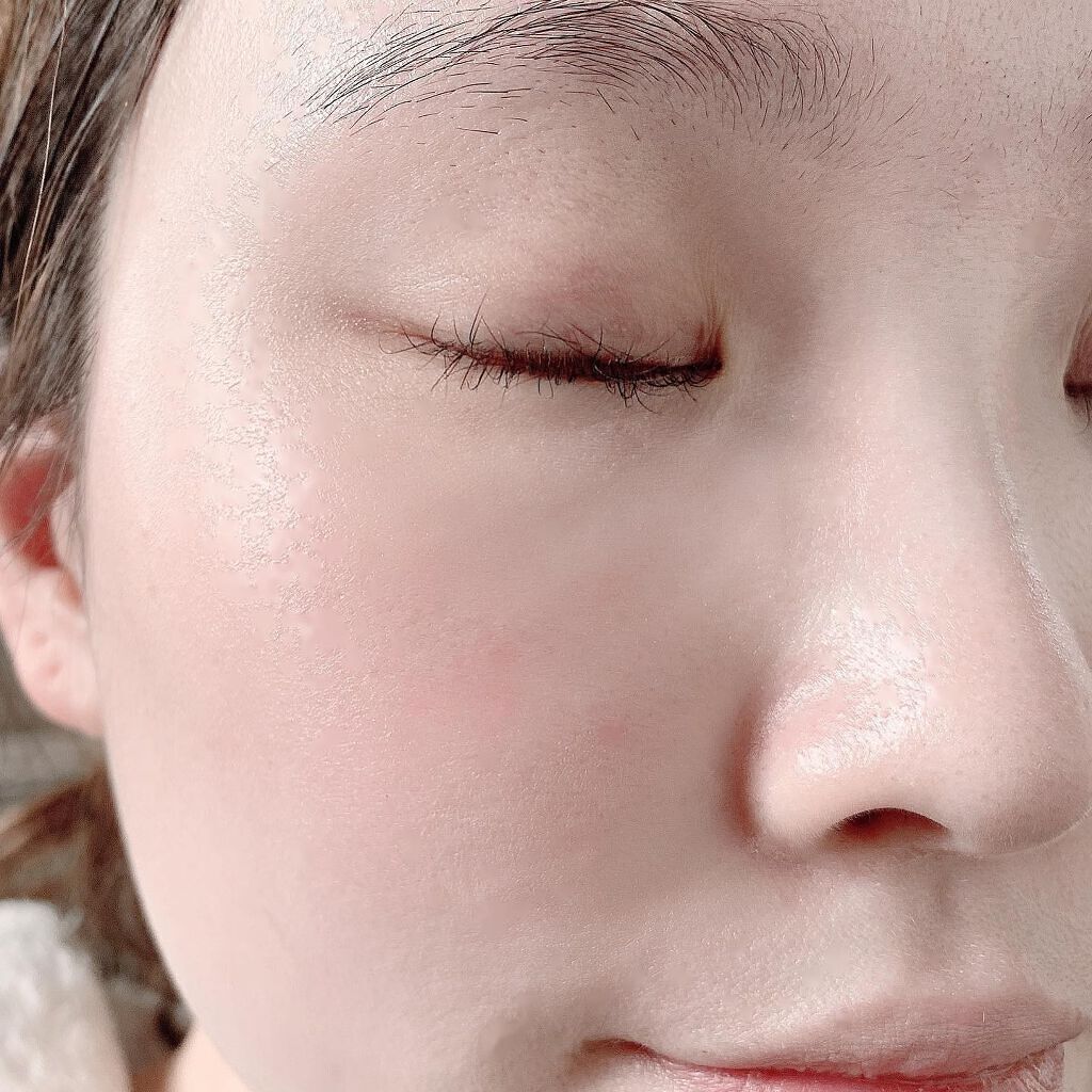 V エッセンス/unlabel/美容液を使ったクチコミ(3枚目)