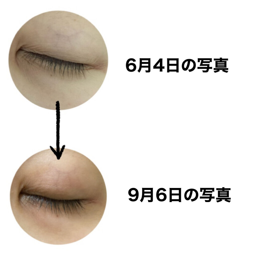 FEG  Eyelash  Enhancer/FEG/まつげ美容液を使ったクチコミ（3枚目）