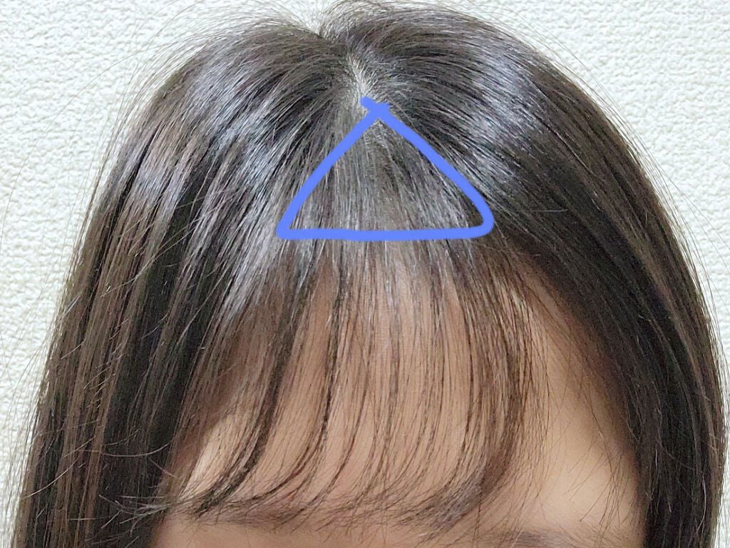 きなこ₺ƾ🍼 on LIPS 「◌𓏸𓈒𓂃垢抜け前髪の作り方𓂃𓈒𓏸◌みなさんこんにちは🌞きなこ₺..」(2枚目)