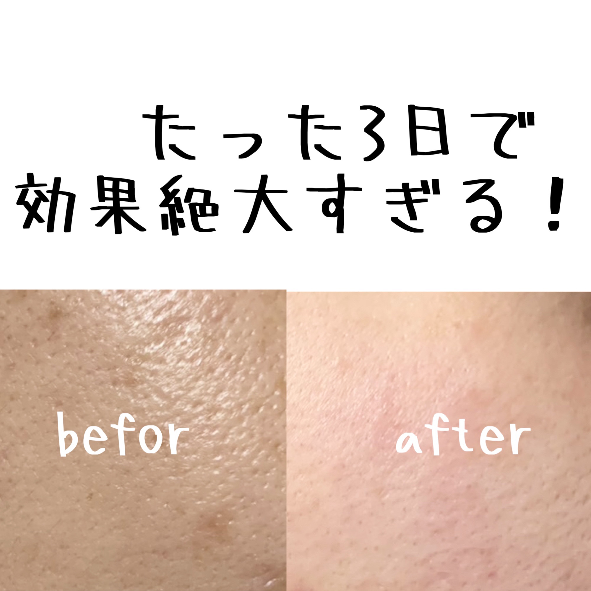 シカバイタル マスク/VT/シートマスク・パックを使ったクチコミ（2枚目）