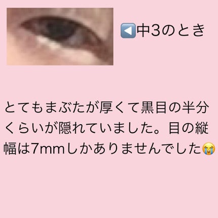二重まぶた用シール/DAISO/二重まぶた用アイテムを使ったクチコミ(2枚目)