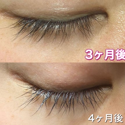 スカルプD ボーテ ピュアフリーアイラッシュセラム/アンファー(スカルプD)/まつげ美容液を使ったクチコミ(1枚目)