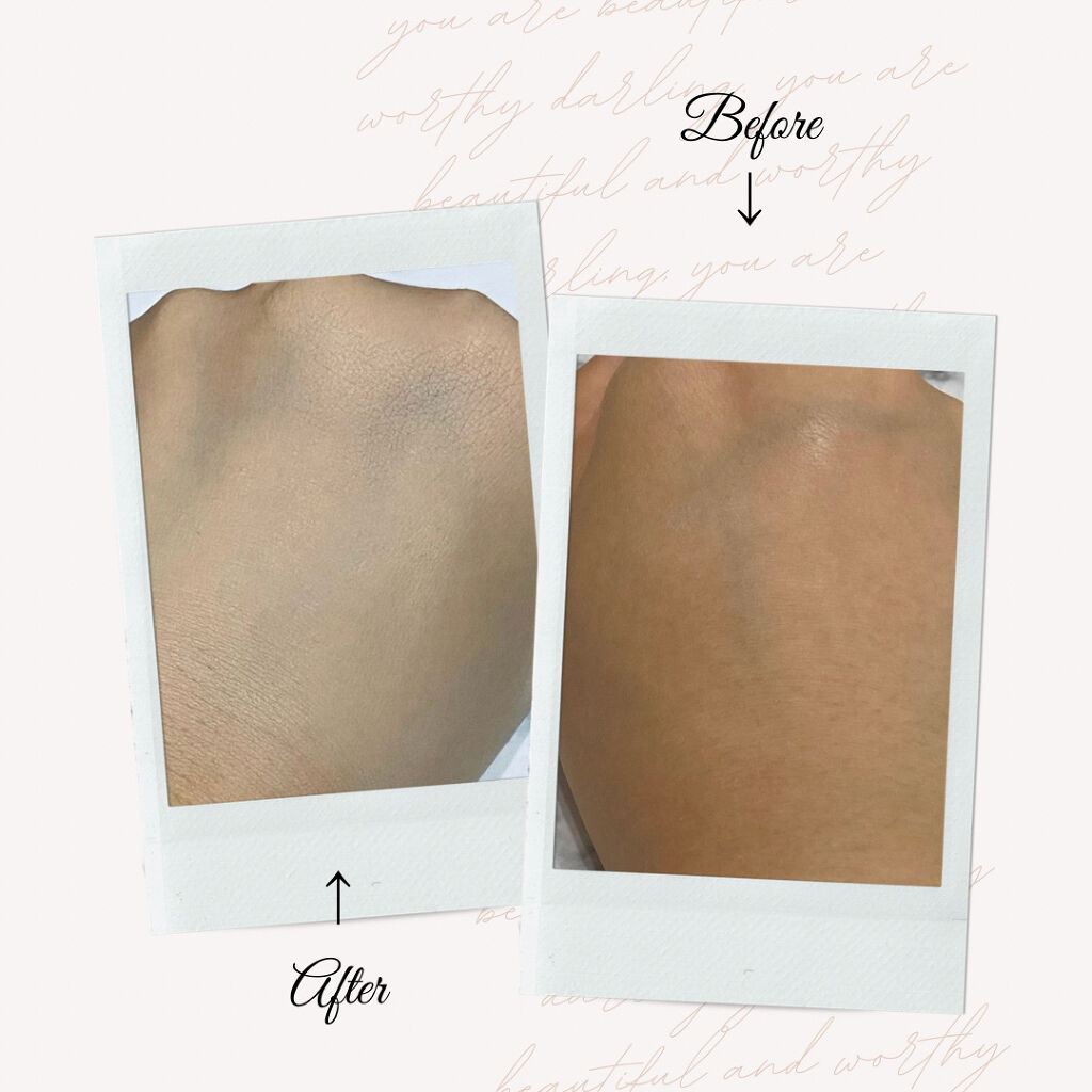 ピンクティーツリーカバークッション/APLIN/クッションファンデーションを使ったクチコミ（3枚目）