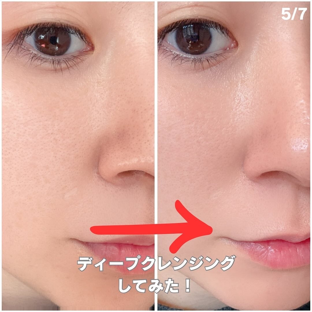 スチーマーZ32/ANLAN/美顔器・マッサージを使ったクチコミ(5枚目)