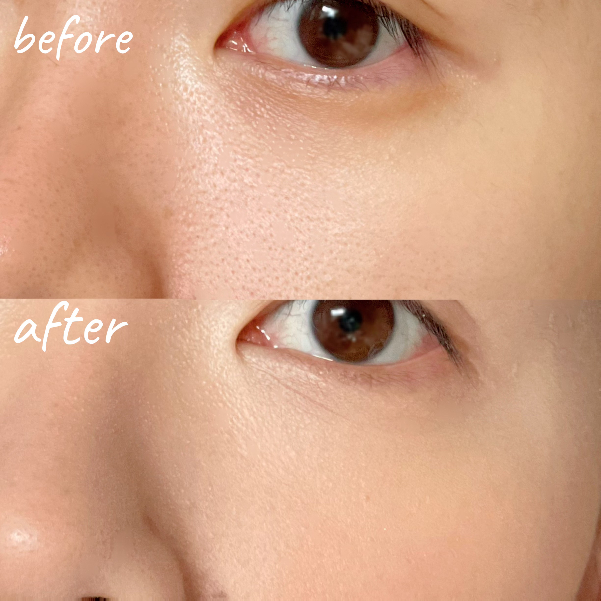 ロングラスティングチップコンシーラー/LUNA/リキッドコンシーラーを使ったクチコミ（2枚目）