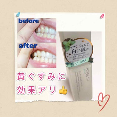 HITEETH ALL IN ONE MOUTH GEL/R&/歯磨き粉を使ったクチコミ（1枚目）