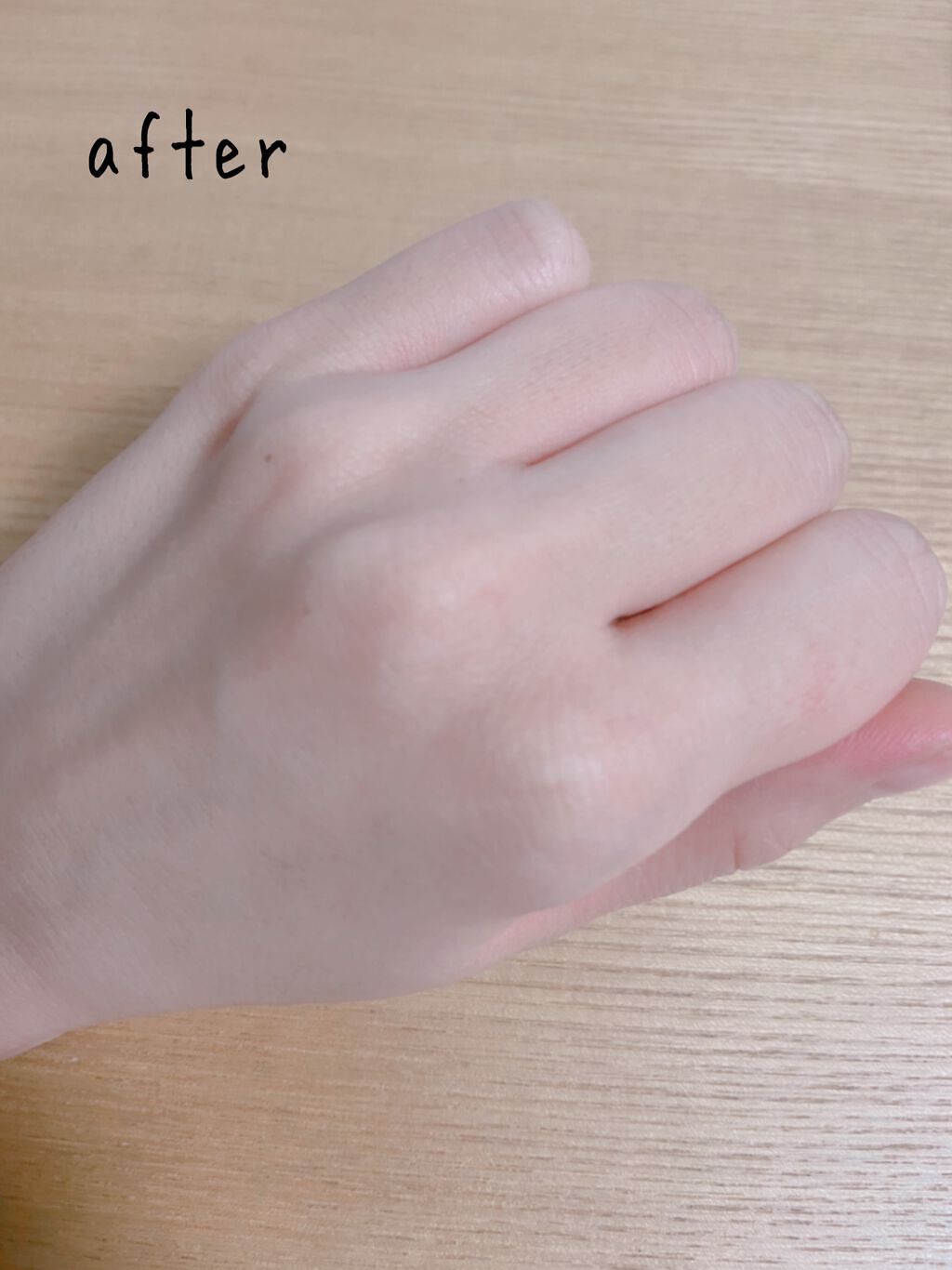 除毛クリームキット敏感肌用/エピラット/除毛クリームを使ったクチコミ（3枚目）