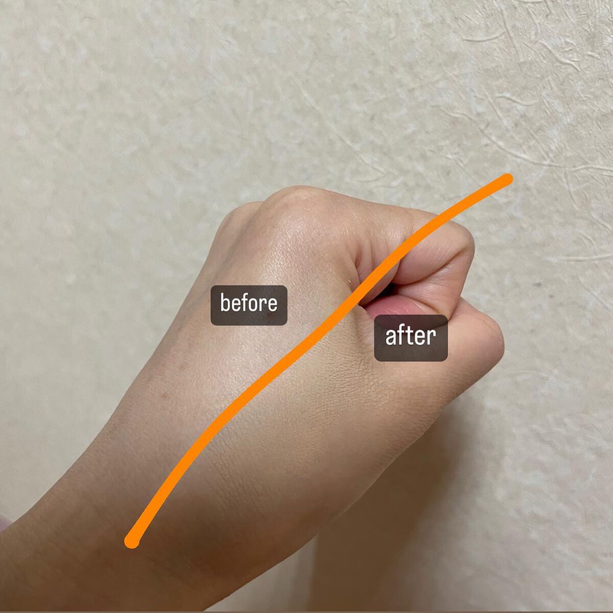 タトゥーウォータープルーフスカーコンシーラー/フォレンコス/リキッドコンシーラーを使ったクチコミ(4枚目)